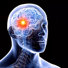 Brain Cancers after Pfizer mRNA Jabs