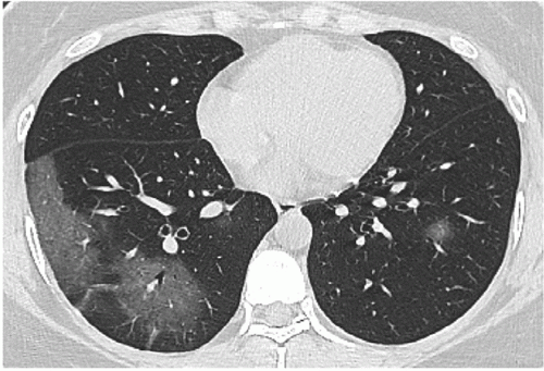 #COVID19 #Coronavirus #2019nCoV #Wuhanvirus #SARScov2 #COVID19 #Coronavirus #2019nCoV #Wuhanvirus #SARScov2