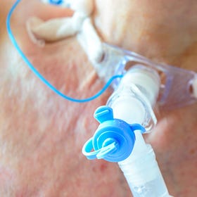 Can Lungpacer® wean your patient off the vent?