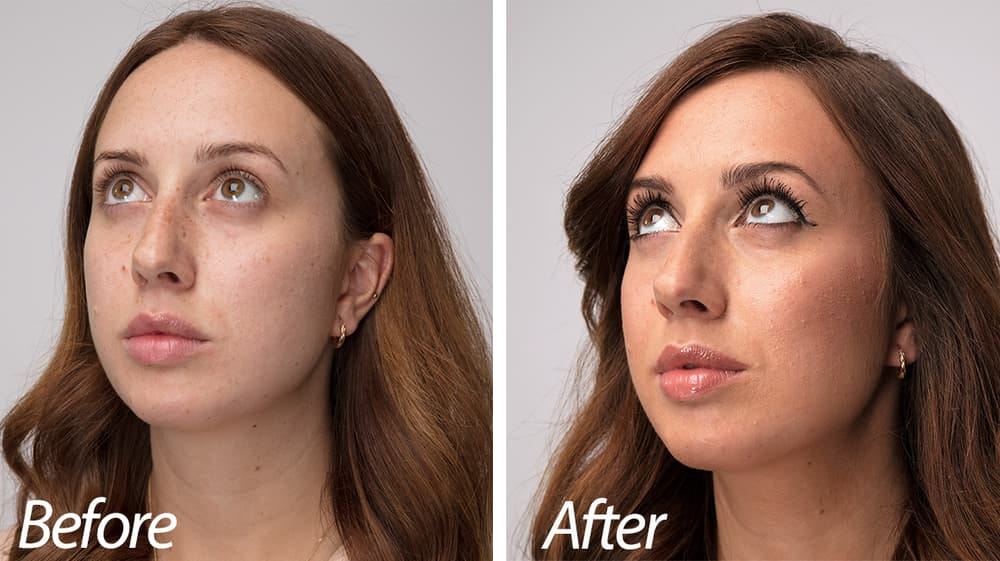 Best Concealer for Dark Circles and Fine Lines