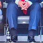 White House Admits Swollen Ankles Indicate Trump Suffers From Condition Of Being Super Old