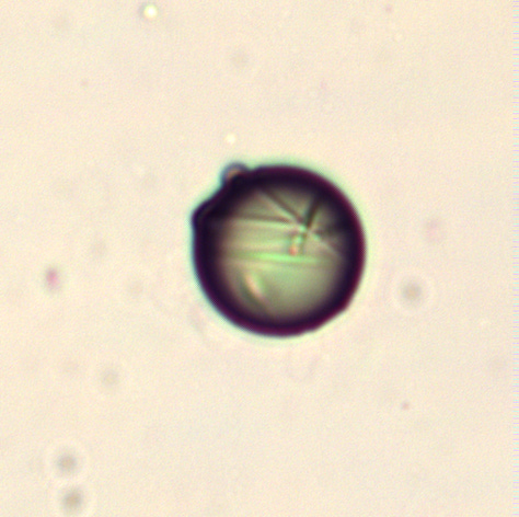 Various Microcapsules taken from various samples using a lab grade LeicaDM2000 microscope at 25x objective and enlarged significantly