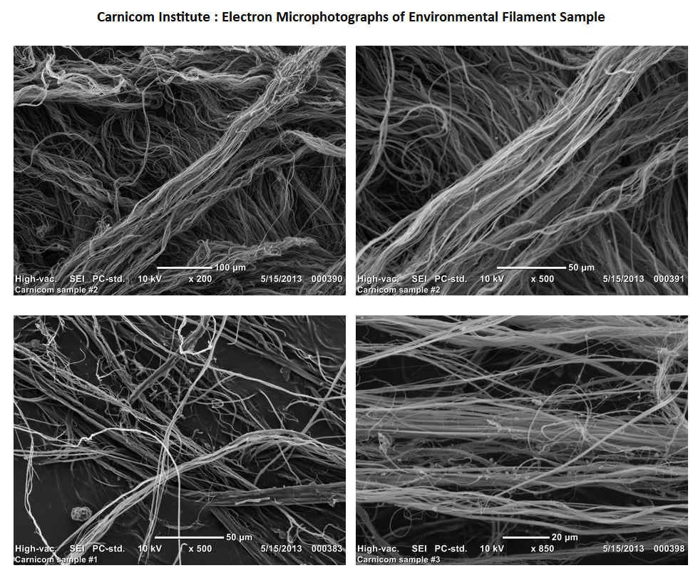 carnicom-electron-micrograph-a