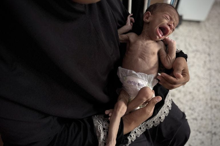 A starving child A starving child
