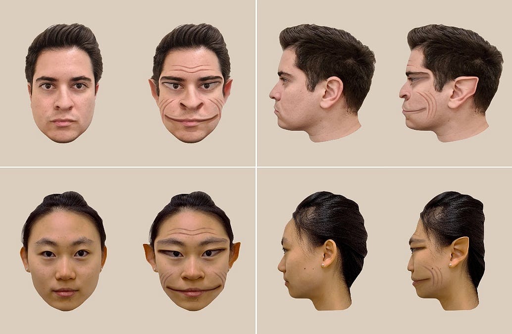 Rare Conditions Makes Others' Faces Appear 'Demonic'