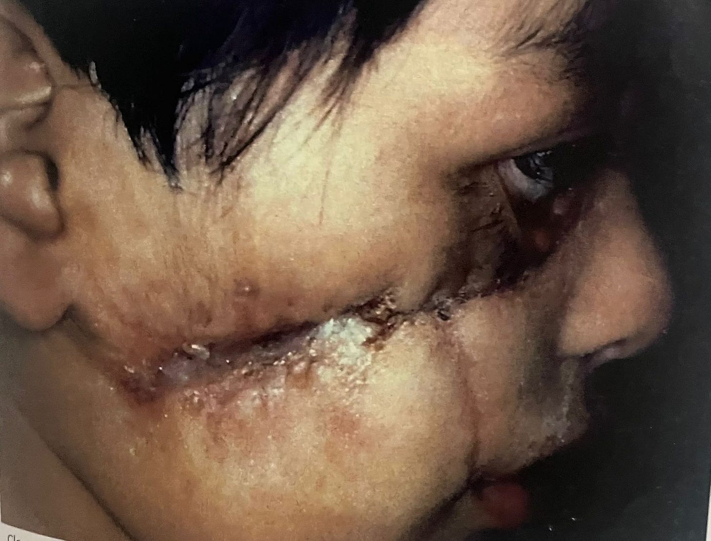 A close up photo of the eye injury. Photo: S. Brian Willson.