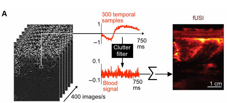 Clutter filtering is a critical step in functional ultrasound imaging. From Rabut et al. (2024). Clutter filtering is a critical step in functional ultrasound imaging. From Rabut et al. (2024).