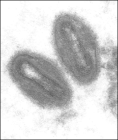 Electron micrograph of monkeypox virus Electron micrograph of monkeypox virus