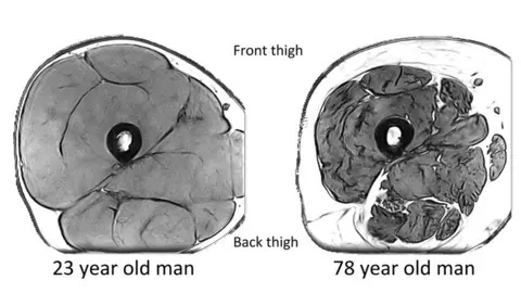 Piasecki et al MRI images of the mid-thigh in a 23-year-old man and a 78-year-old