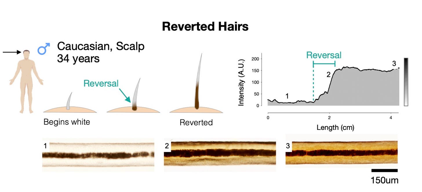 This figure provides an example of a reverted hair that began growing as grey and then reverted back to brown.
