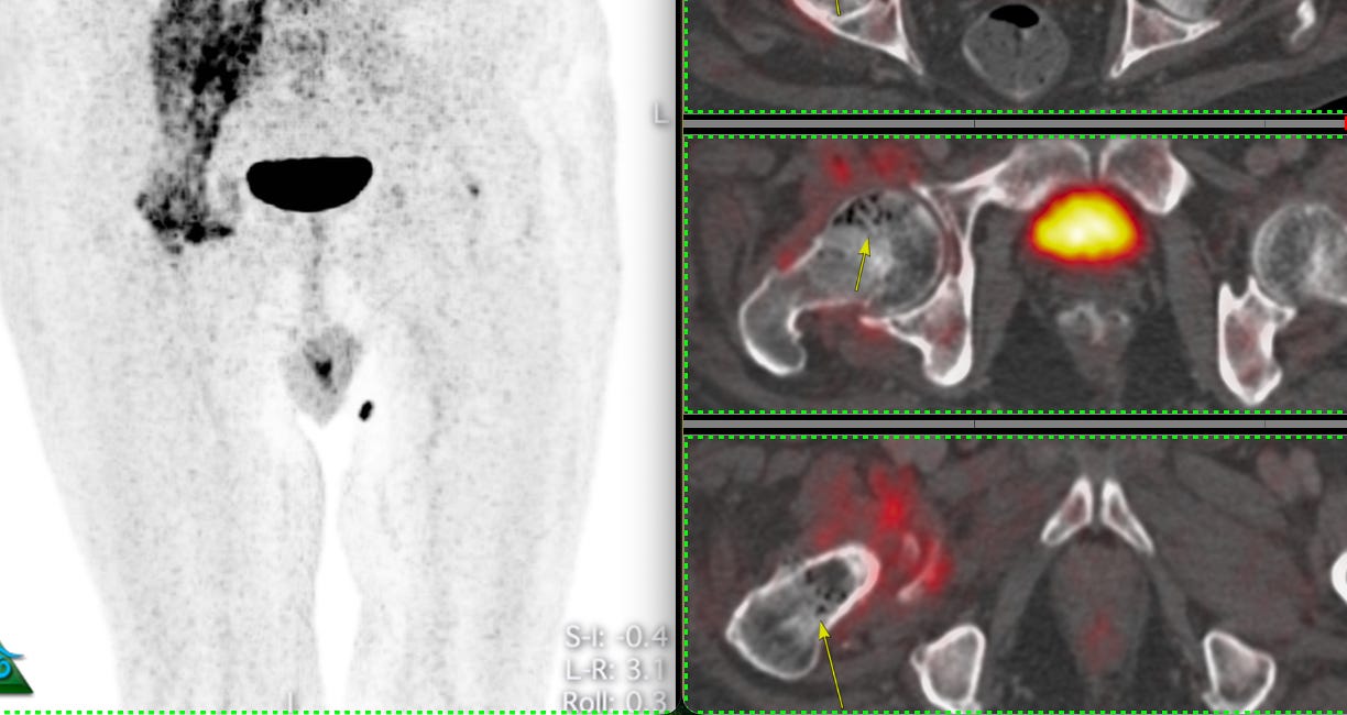 Case 73 - The Pumice Stone Sign