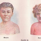 CDC Deputy Director Unclear On How It's *His* Job To Prevent Contagious Diseases Like Measles