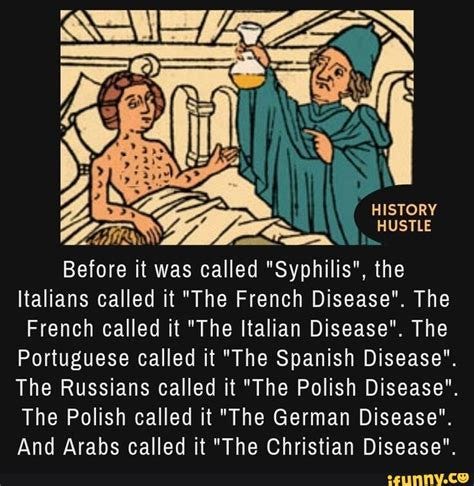 HISTORY HUSTLE Before it was called "Syphilis", the Italians called it ... HISTORY HUSTLE Before it was called "Syphilis", the Italians called it ...