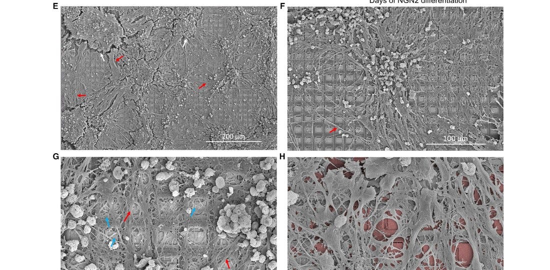 Scanning electron microscopy of cortical neurons on HD-MEA chip