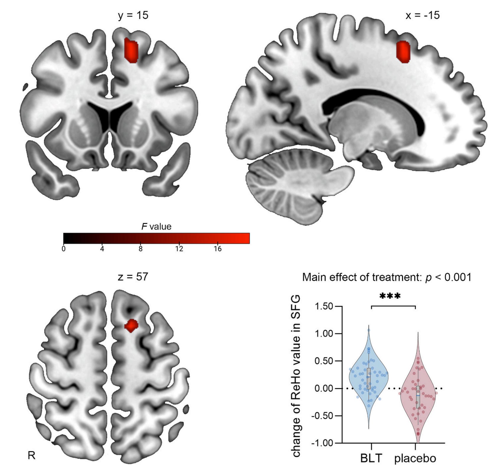 Does Morning Light Clean the Brain? A New Mechanism for How Light ...