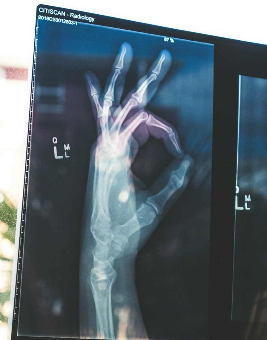 citiscan result hand ok