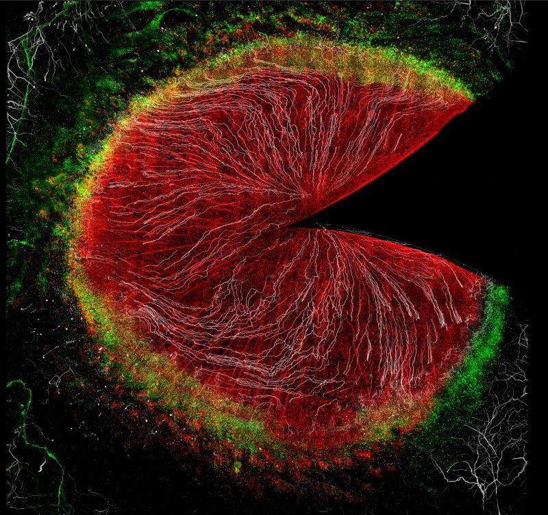 Hidden Network Inside the Eye: Yale 2026 Discovery