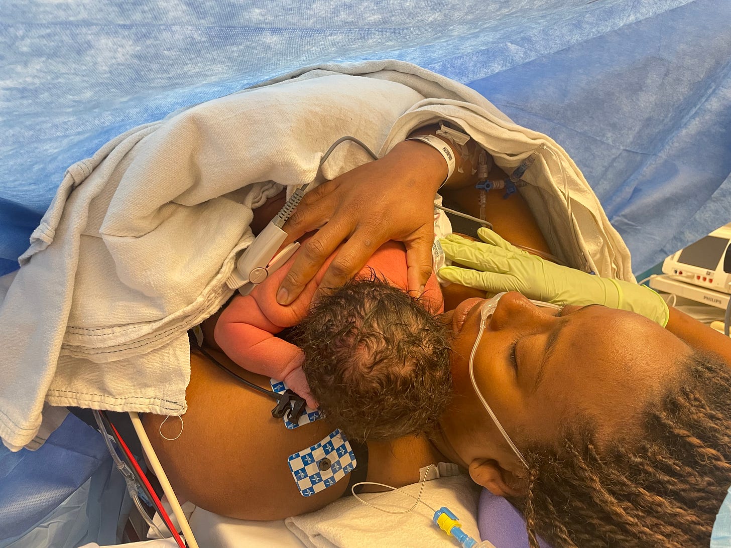 Black woman holding infant to her chest on the OR table