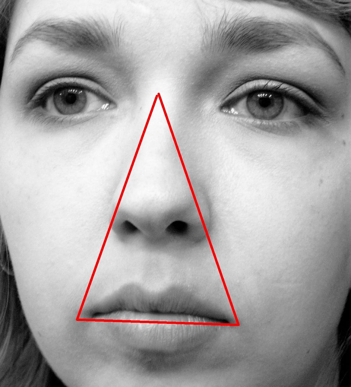 https://en.wikipedia.org/wiki/Danger_triangle_of_the_face#/media/File:Danger_triangle_of_the_face_diagram.jpg