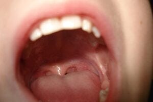 Open mouth