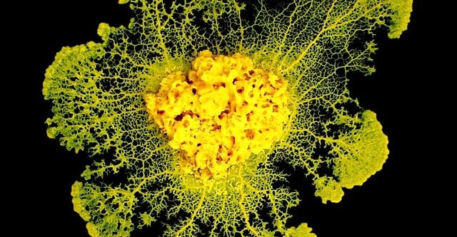 TIL Scientists put slime mold onto a model of a map of Tokyo, with food  representing urban centers. After a day, it created a network almost  identical to Tokyo's actual rail network.