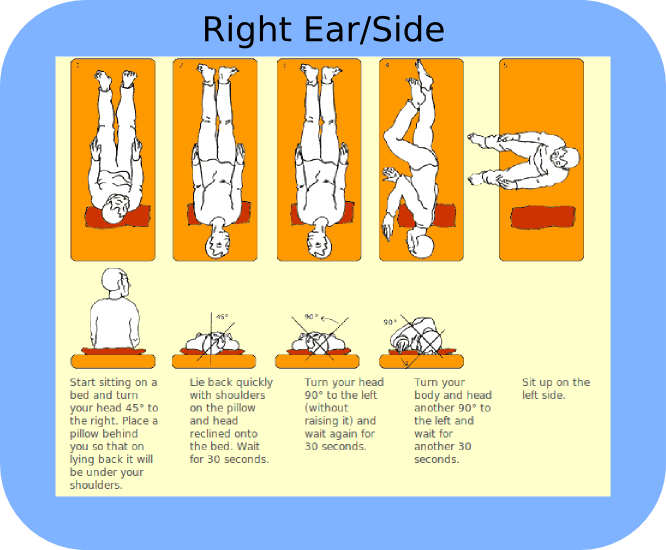 Epley Maneuver | Tampa Bay Hearing and Balance Center