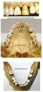Santa Cruz Jane Doe 1957