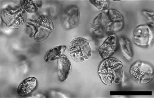 Entre le virus et l'amibe, la sale gueule de Karenia Mikomotoi vue au microscope.