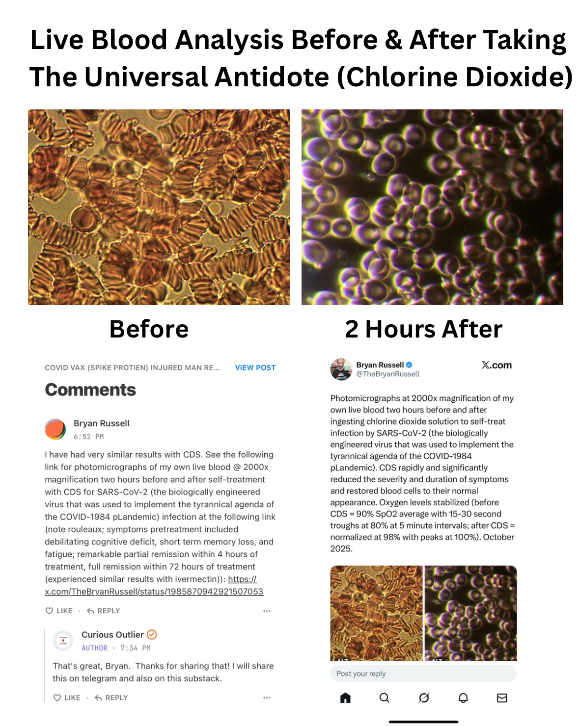 Skin Cancer Eliminated With The Universal Antidote (Chlorine Dioxide).png