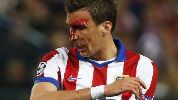 mario mandzukic bloodied up for champions league soccer 2015 mario mandzukic bloodied up for champions league soccer 2015