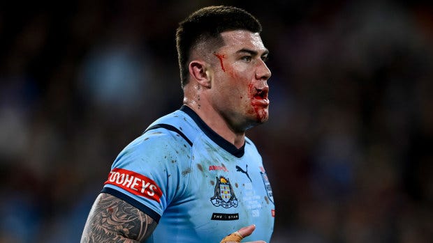State of Origin 2024: Bradman Best lip injury, how it happened, head clash Brian To'o, comments, reaction, video State of Origin 2024: Bradman Best lip injury, how it happened, head clash Brian To'o, comments, reaction, video