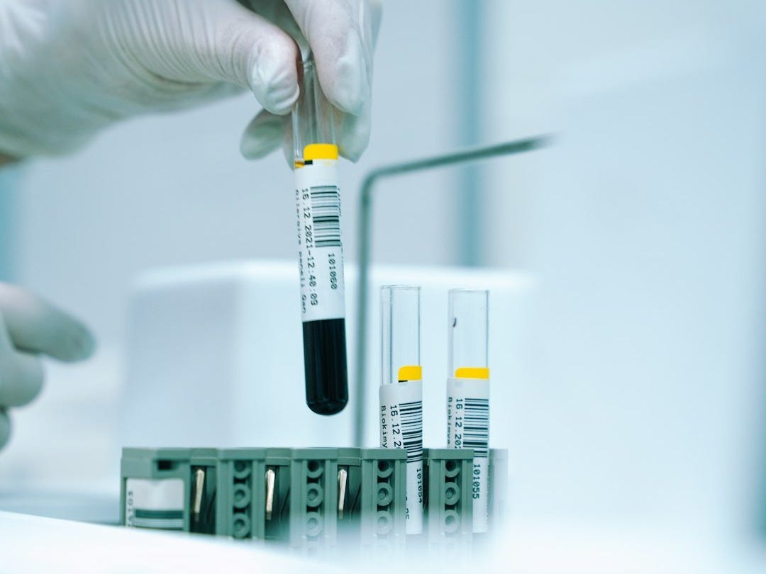 Galleri : le test sanguin qui pourrait sauver des milliers de vies