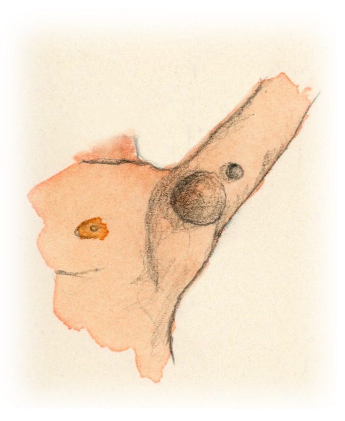 illustration of buboes in the armpit illustration of buboes in the armpit