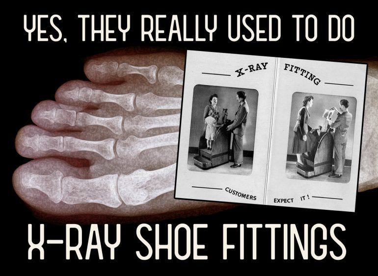 How X-ray shoe fittings used to really be a thing years ago How X-ray shoe fittings used to really be a thing years ago