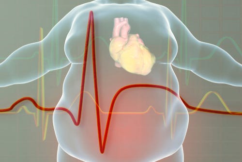 The Connection between Obesity and Cardiovascular Disease - SLMA