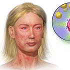 Can cell phones cause eczema?