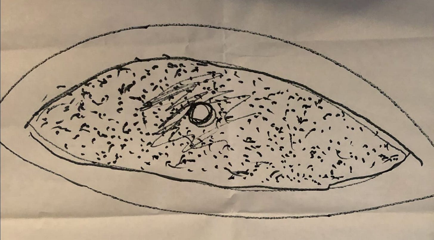 The image is an ink drawing of an eye with dots throughout and the center of the eye shaded. The image is an ink drawing of an eye with dots throughout and the center of the eye shaded.