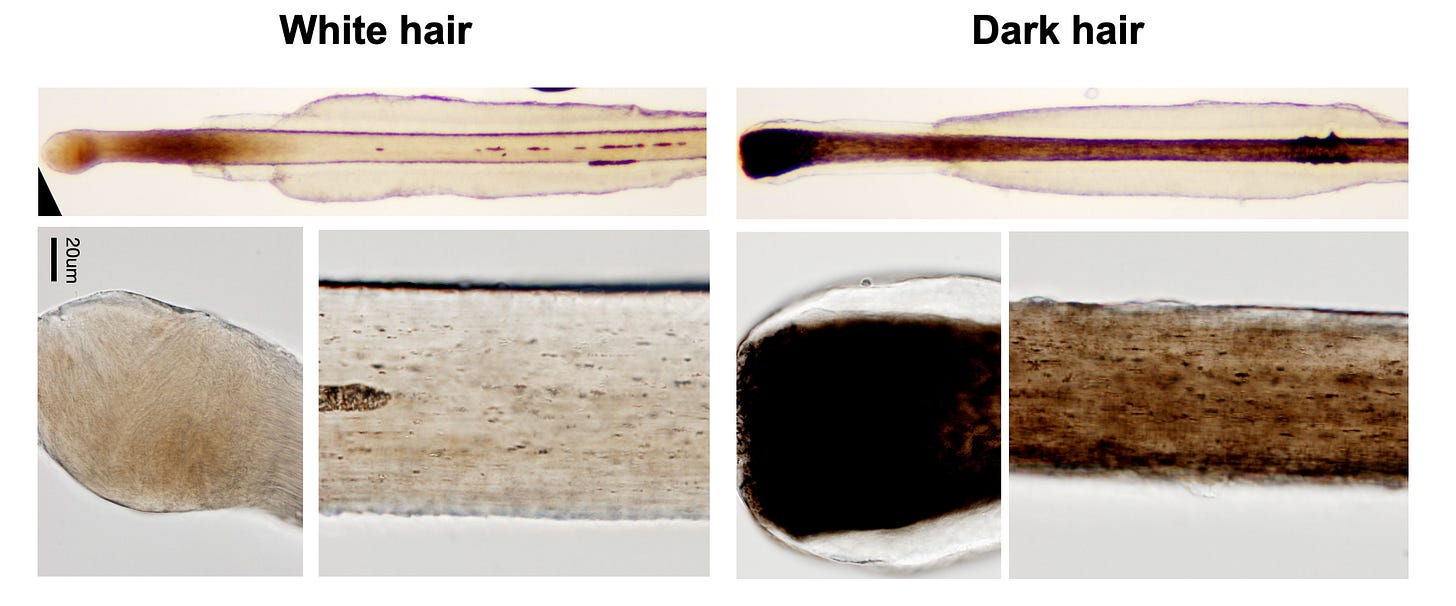 Microscope images of a white hair (left) and dark hair (right). 