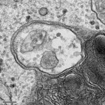 Autophagosome: Lysosome fusion | Yin (Helen) Lab | UT Southwestern, Dallas,  Texas