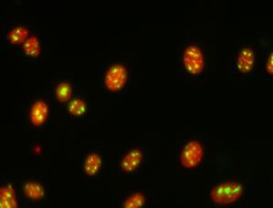 nucleoli nucleoli