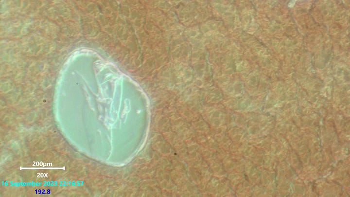 Laser scanning microscopy of ring constructor cell in blood. no remarkable activity observed applying 532nm laser. Right image is laser and white light source.