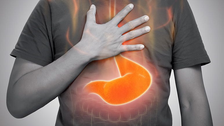 heartburn products