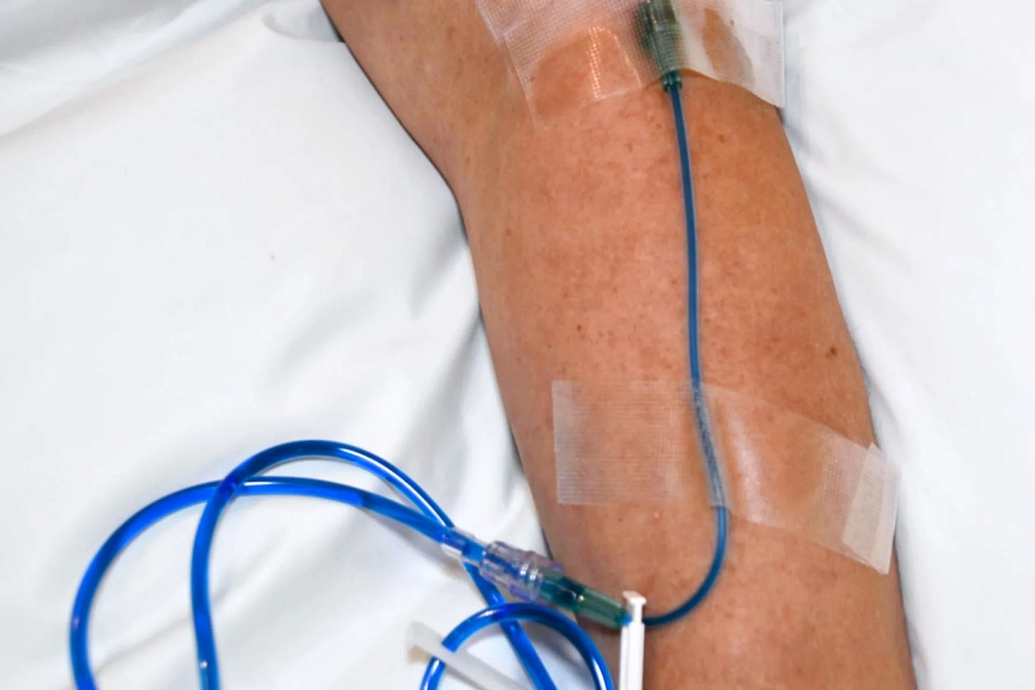 Methylene Blue: How It Works