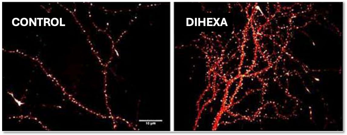 dihexa synaptogenesis neurogenesis 10 Million Times Stronger Than BDNF? The Truth About 4 PACK - NEUROBION acne korean Shaft - Flex:True Temper Dynamic Gold Mid 115 Steel - Stiff