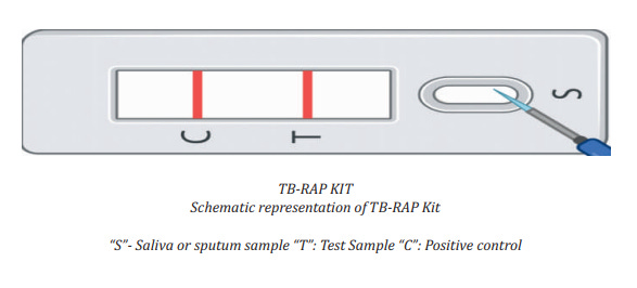 Developed Rapid Non-Invasive Diagnostic Kits (TB-RAP) for Tuberculosis 