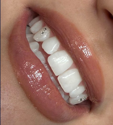 kola payer gemme dentali