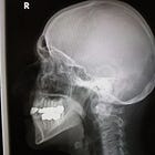 The Hell of Trying to Get Paid Medical Leave In America