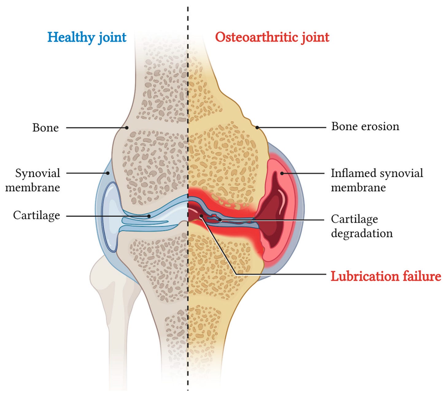 Lubricant Strategies in Osteoarthritis Treatment: Transitioning from Natural Lubricants to Drug ... Lubricant Strategies in Osteoarthritis Treatment: Transitioning from Natural Lubricants to Drug ...