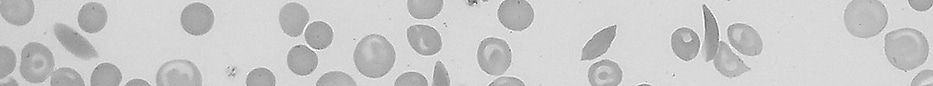 Sickle Cell.png