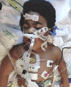 Milo After COVID Shot Milo After COVID Shot